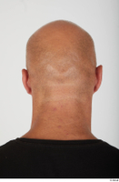  Photos Bobby Hyde bald head 0004.jpg